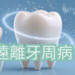 不少人發現自己每天早晚刷牙、使用漱口水，甚至覺得牙齒表面已刷得很乾淨，但洗牙時仍被告知有牙齦發炎、牙周袋加深、牙結石，或早期牙周病問題。這種情況其實並不罕見，因為牙周病並不是單靠「有沒有刷牙」便能完全避免，而是與刷牙方式、清潔範圍、牙菌膜堆積、牙結石、生活習慣、身體狀況及定期檢查都有關係。